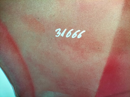 BLATOBRAN PREDNJA STRANA DESNA FIAT GRANDE PUNTO 05- EVO 09-